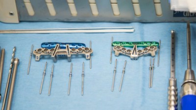 Drukowany implant przedramienia z&nbsp;podbiałostockiego ChM