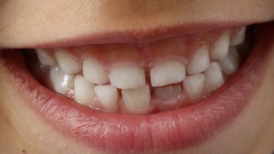 Bezpłatny przegląd stomatologiczny dla dzieci i&nbsp;młodzieży
