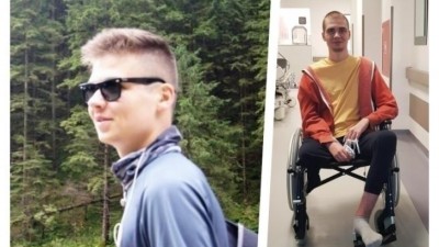 Stracił nogę, ale będzie mógł chodzić - trzeba pomóc młodemu człowiekowi