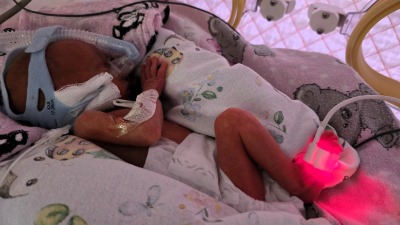 Narodziny trojaczków w USK